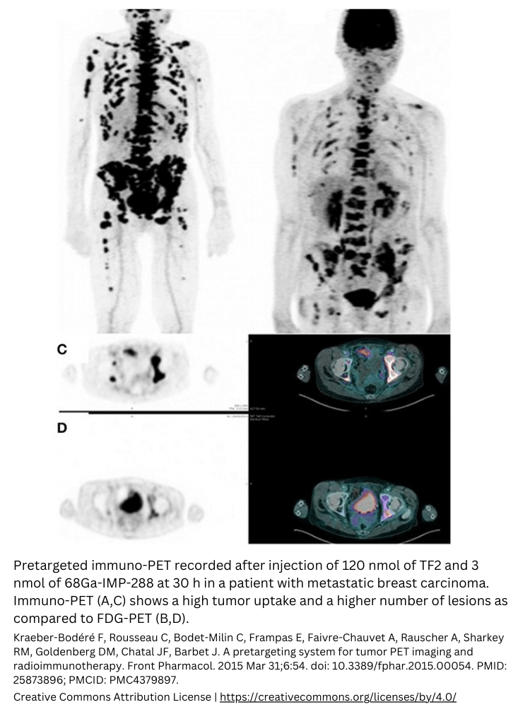 Immuno-PET example nuclear imaging