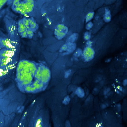 First in-human fluorescent result