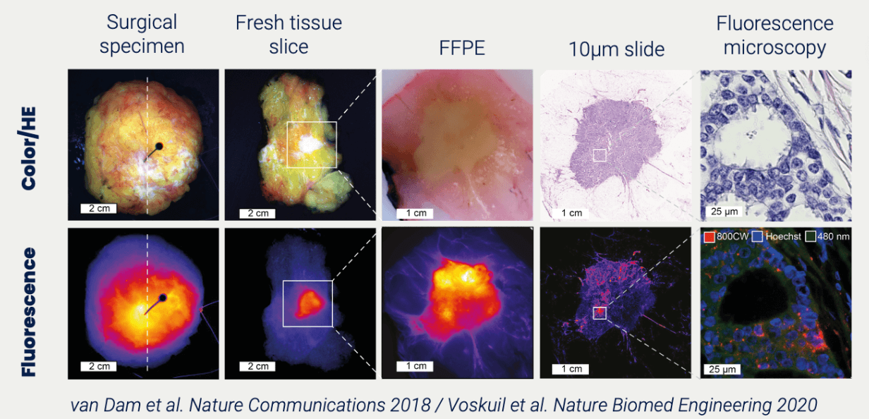 Molecular-imaging