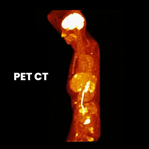 pet ct scan imaging clinical trial